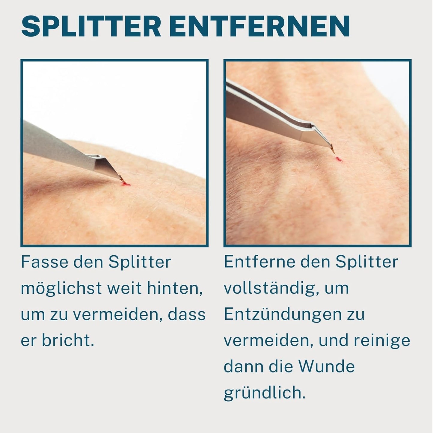 REMOS Kombipinzette Edelstahl [Inox]Rostfrei 9.5 Cm - 2In1 Für Splitter - Haare