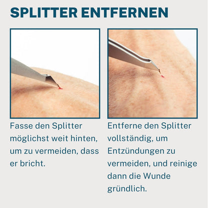 REMOS Kombipinzette Edelstahl [Inox]Rostfrei 9.5 Cm - 2In1 Für Splitter - Haare